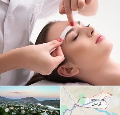 اپیلاسیون در لواسان