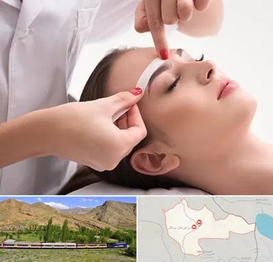 اپیلاسیون در خاش