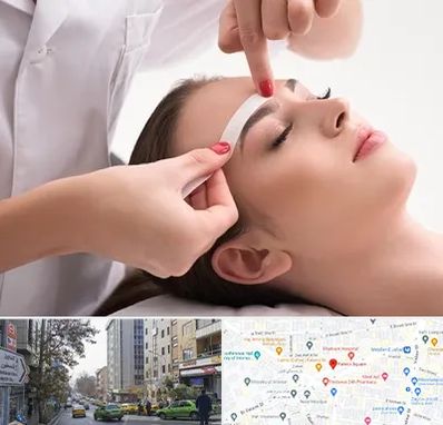 اپیلاسیون در فاطمی