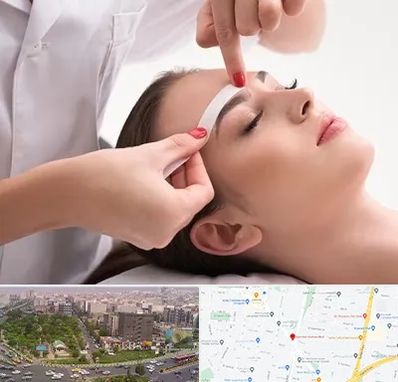 اپیلاسیون در آیت الله کاشانی