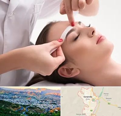 اپیلاسیون در سنندج