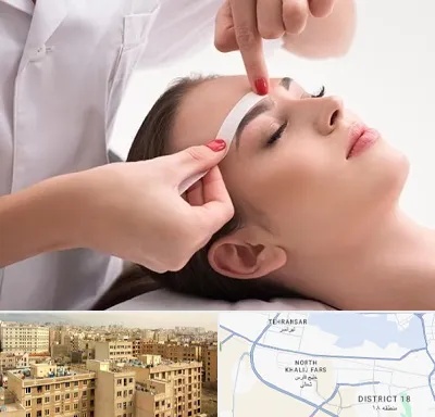 اپیلاسیون در جنوب غرب تهران