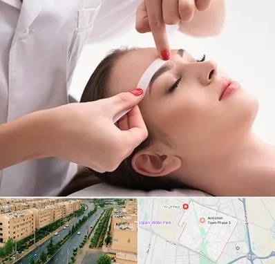 اپیلاسیون در فاز سه اندیشه