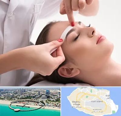 اپیلاسیون در کیش