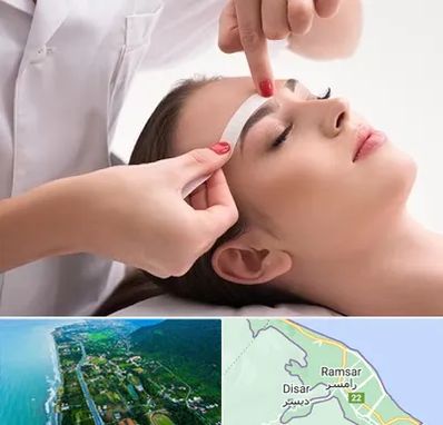 اپیلاسیون در رامسر