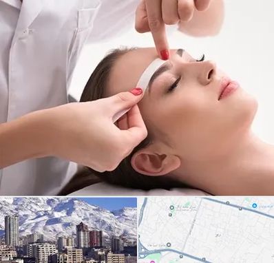 اپیلاسیون در ازگل