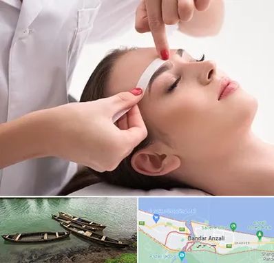 اپیلاسیون در بندر انزلی