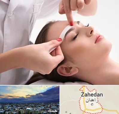 اپیلاسیون در زاهدان