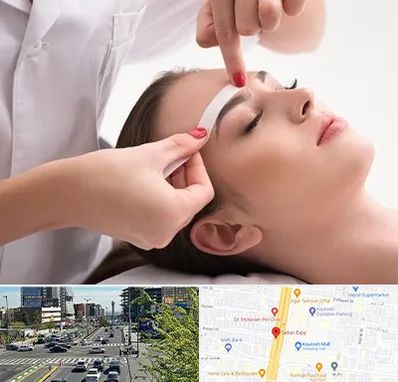 اپیلاسیون در ستاری