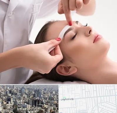 اپیلاسیون در جیحون