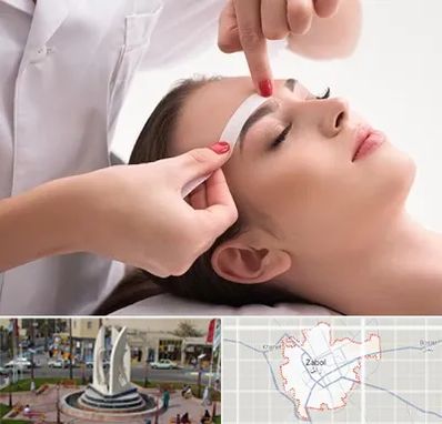 اپیلاسیون در زابل