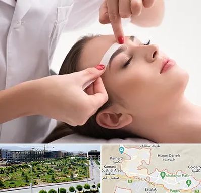 اپیلاسیون در پردیس