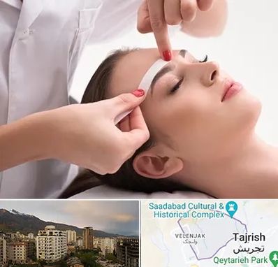 اپیلاسیون در زعفرانیه 