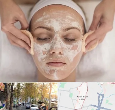 آموزشگاه پاکسازی پوست در کاشانک