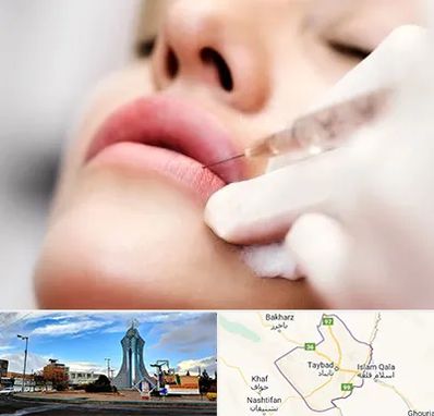 کلینیک تزریق ژل لب در تایباد
