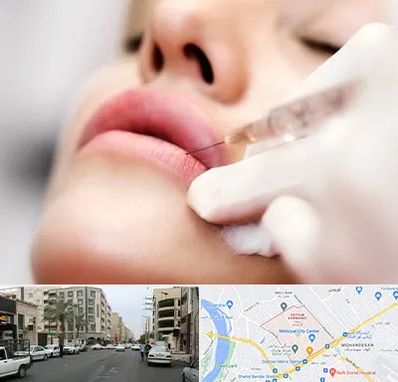 کلینیک تزریق ژل لب در زیتون کارمندی اهواز