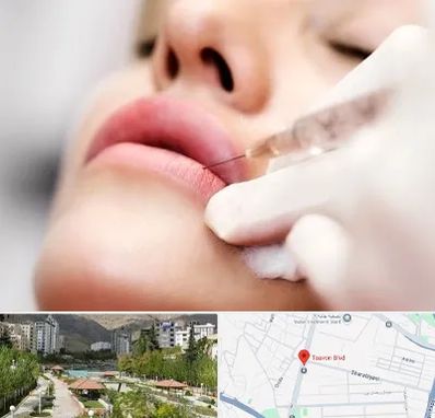 کلینیک تزریق ژل لب در بلوار تعاون