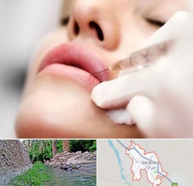 کلینیک تزریق ژل لب در سراوان