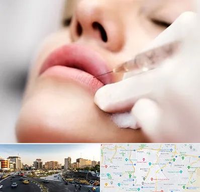 کلینیک تزریق ژل لب در منطقه 7 تهران