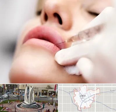 کلینیک تزریق ژل لب در زابل