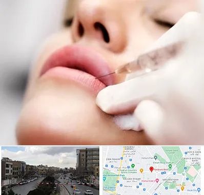کلینیک تزریق ژل لب در بلوار فردوسی مشهد