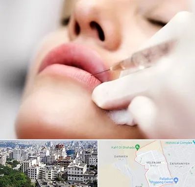 کلینیک تزریق ژل لب در ولنجک