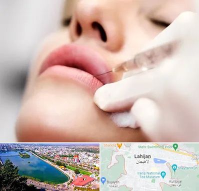 کلینیک تزریق ژل لب در لاهیجان