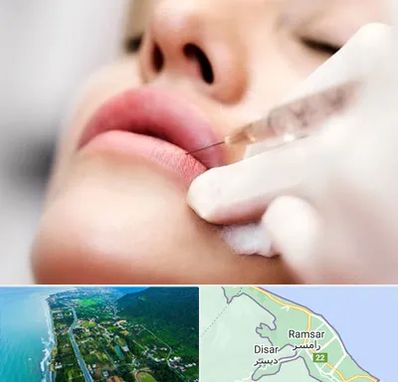 کلینیک تزریق ژل لب در رامسر