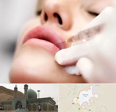 کلینیک تزریق ژل لب در شهرضا