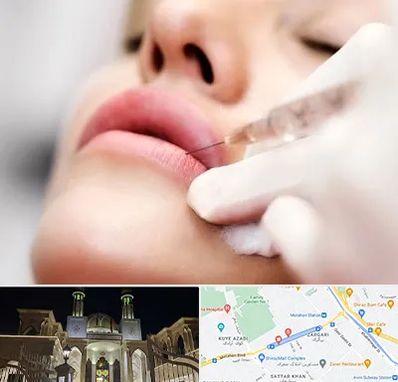کلینیک تزریق ژل لب در زرگری شیراز