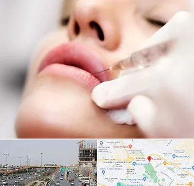 کلینیک تزریق ژل لب در بلوار توس مشهد