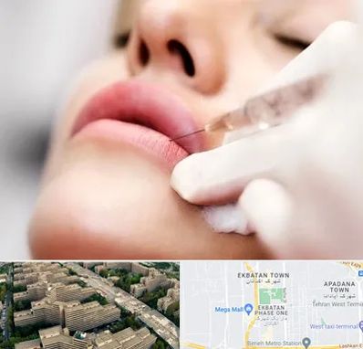 کلینیک تزریق ژل لب در اکباتان