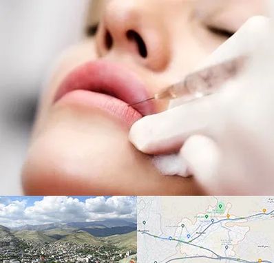 کلینیک تزریق ژل لب در رودهن