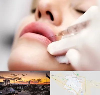 کلینیک تزریق ژل لب در قوچان