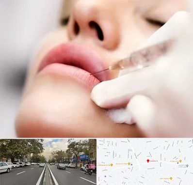 کلینیک تزریق ژل لب در دولت