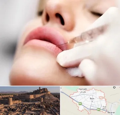کلینیک تزریق ژل لب در بم