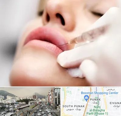 کلینیک تزریق ژل لب در پونک