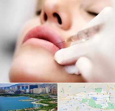 کلینیک تزریق ژل لب در منطقه 22 تهران