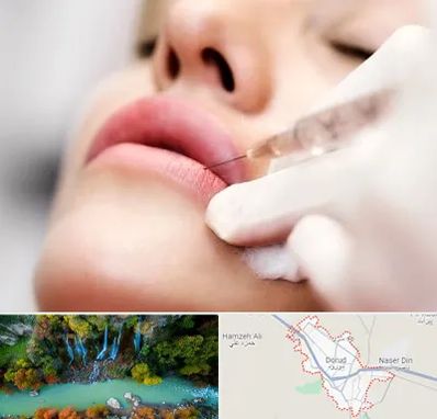 کلینیک تزریق ژل لب در دورود