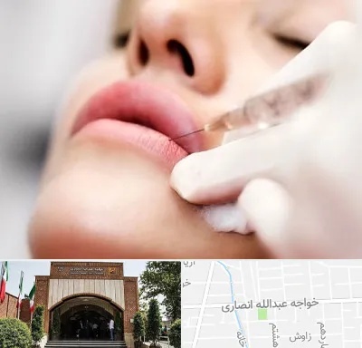 کلینیک تزریق ژل لب در خواجه عبدالله
