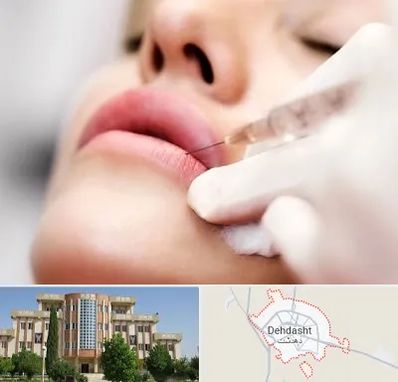 کلینیک تزریق ژل لب در دهدشت