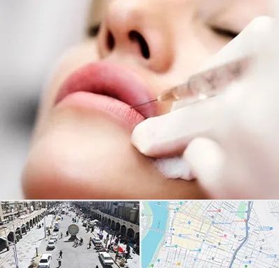 کلینیک تزریق ژل لب در نادری اهواز
