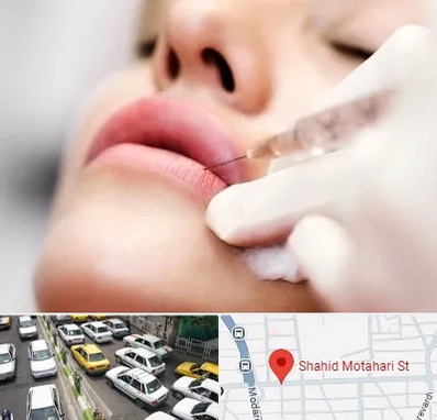کلینیک تزریق ژل لب در مطهری تهران