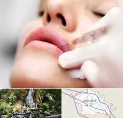 کلینیک تزریق ژل لب در الیگودرز