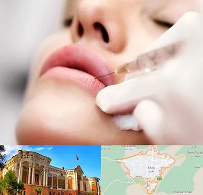 کلینیک تزریق ژل لب در خوی