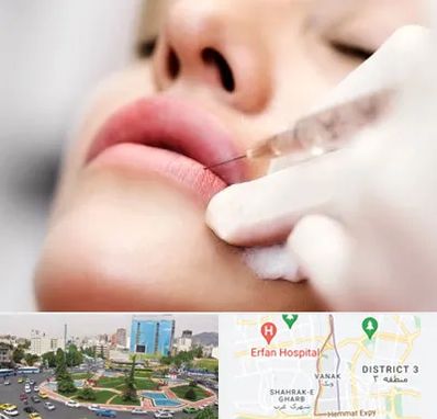 کلینیک تزریق ژل لب در ونک تهران