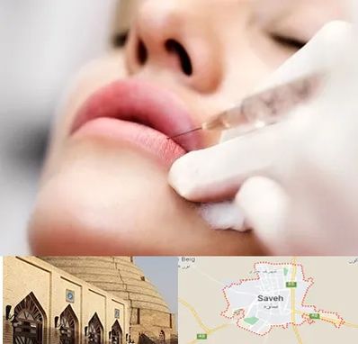 کلینیک تزریق ژل لب در ساوه
