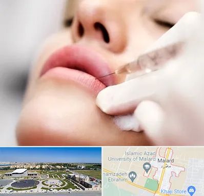 کلینیک تزریق ژل لب در ملارد