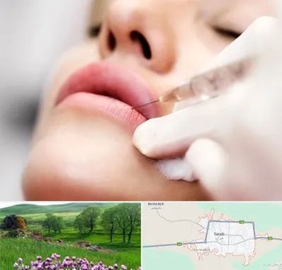 کلینیک تزریق ژل لب در سراب