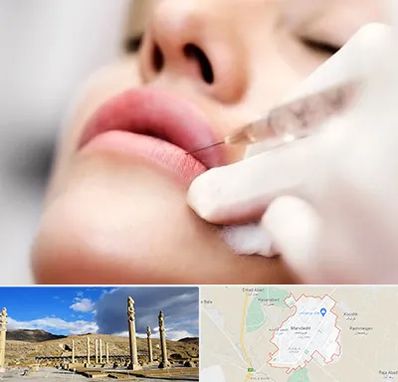 کلینیک تزریق ژل لب در مرودشت